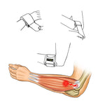 Tennis Elbow Strap (Epicondylitis) by 4Dflexisport